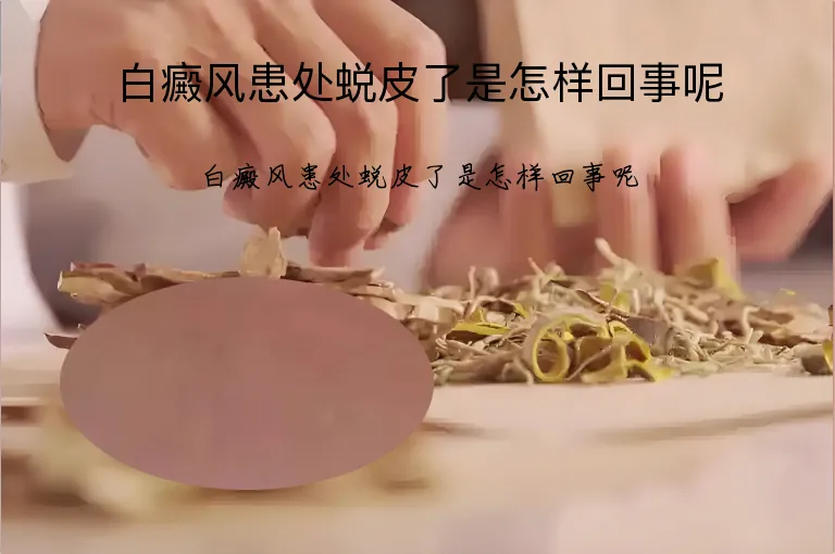 白癜风患处蜕皮了是怎样回事呢