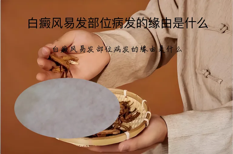 白癜风易发部位病发的缘由是什么