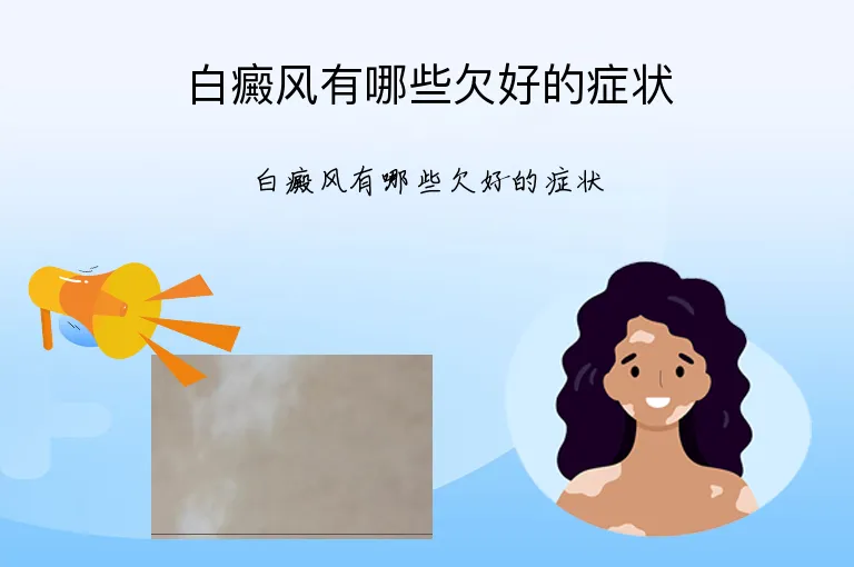 白癜风有哪些欠好的症状