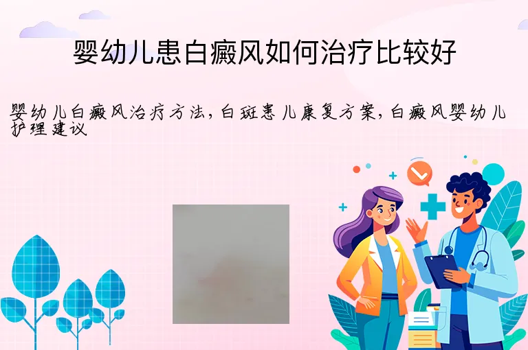 婴幼儿患白癜风如何治疗比较好