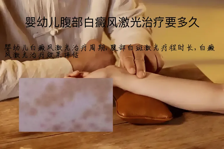 婴幼儿腹部白癜风激光治疗要多久