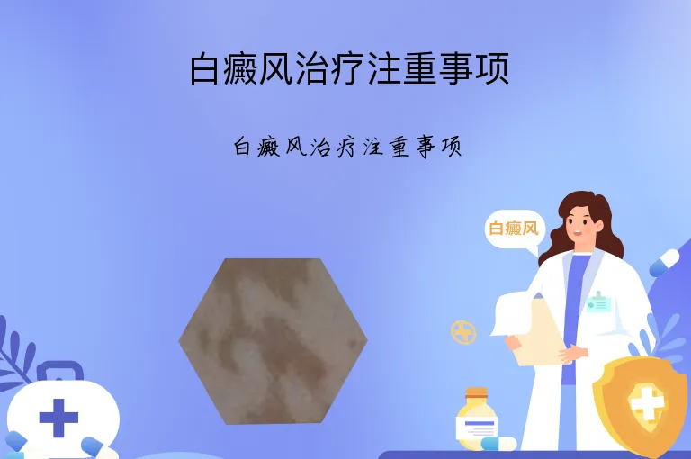 白癜风治疗注重事项