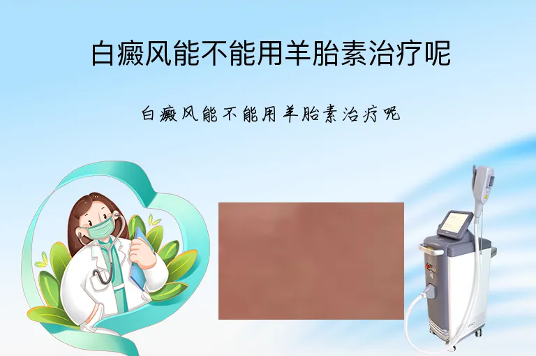 白癜风能不能用羊胎素治疗呢