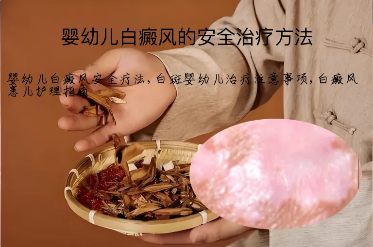 婴幼儿白癜风的安全治疗方法