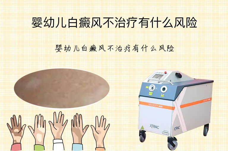 婴幼儿白癜风不治疗有什么风险