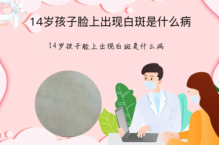 14岁孩子脸上出现白斑是什么病