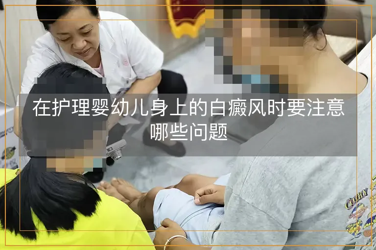 在护理婴幼儿身上的白癜风时要注意哪些问题