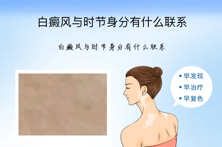 白癜风与时节身分有什么联系