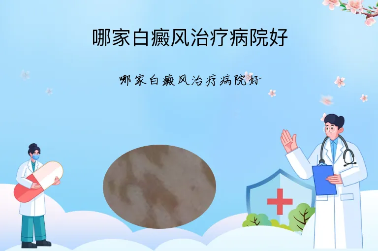哪家白癜风治疗病院好