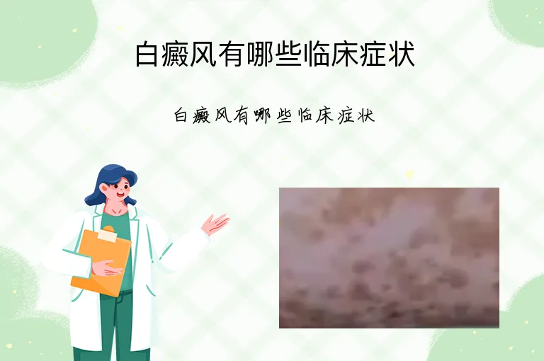 白癜风有哪些临床症状