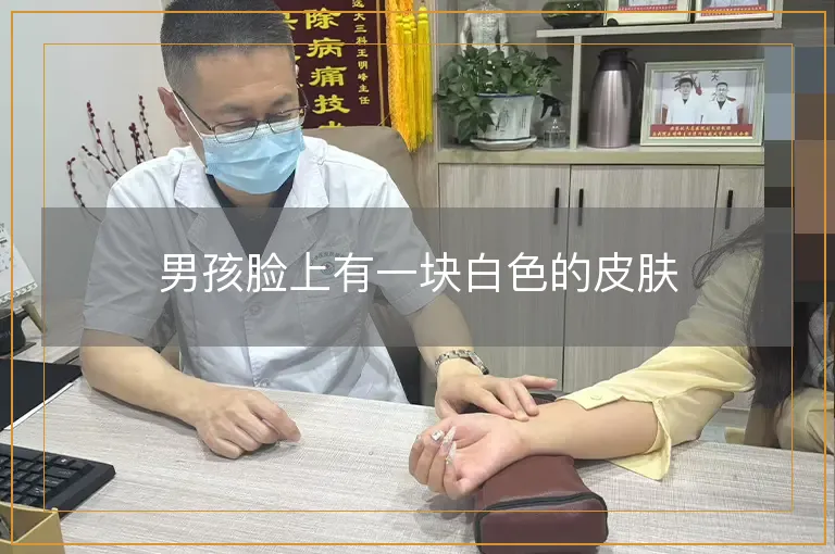 男孩脸上有一块白色的皮肤