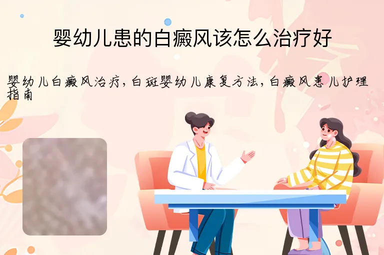 婴幼儿患的白癜风该怎么治疗好