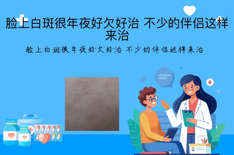 脸上白斑很年夜好欠好治 不少的伴侣这样来治