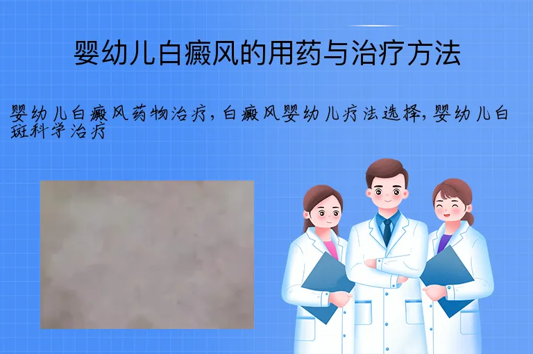 婴幼儿白癜风的用药与治疗方法
