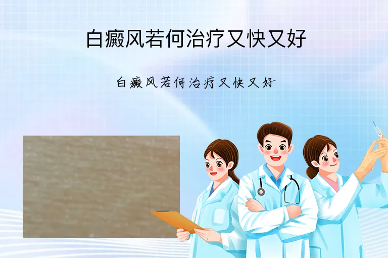 白癜风若何治疗又快又好