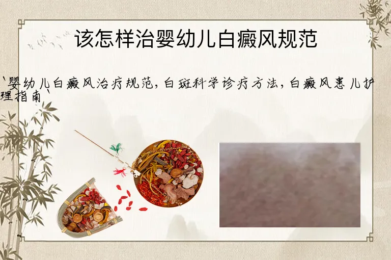 该怎样治婴幼儿白癜风规范