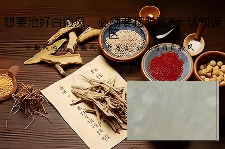 想要治好白癜风，必须要摆脱这5大认知误区