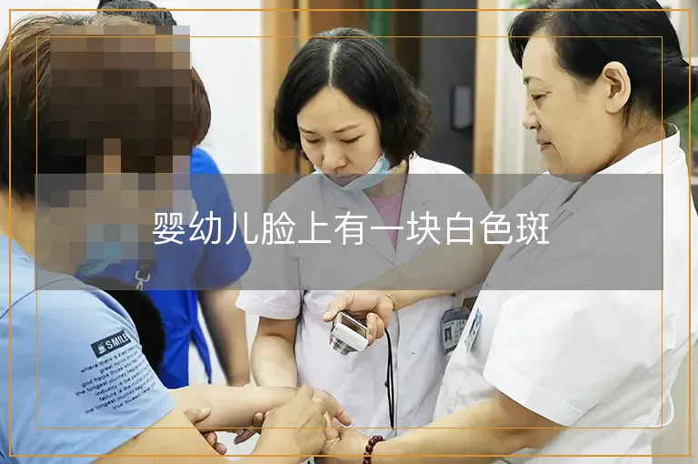 婴幼儿脸上有一块白色斑