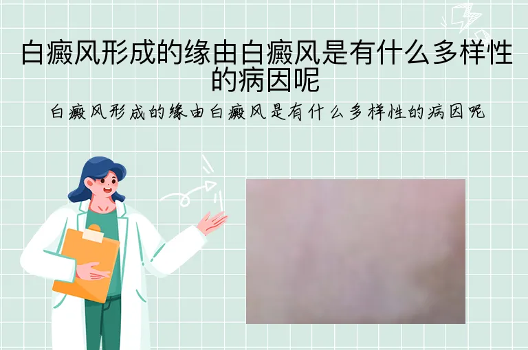 白癜风形成的缘由白癜风是有什么多样性的病因呢