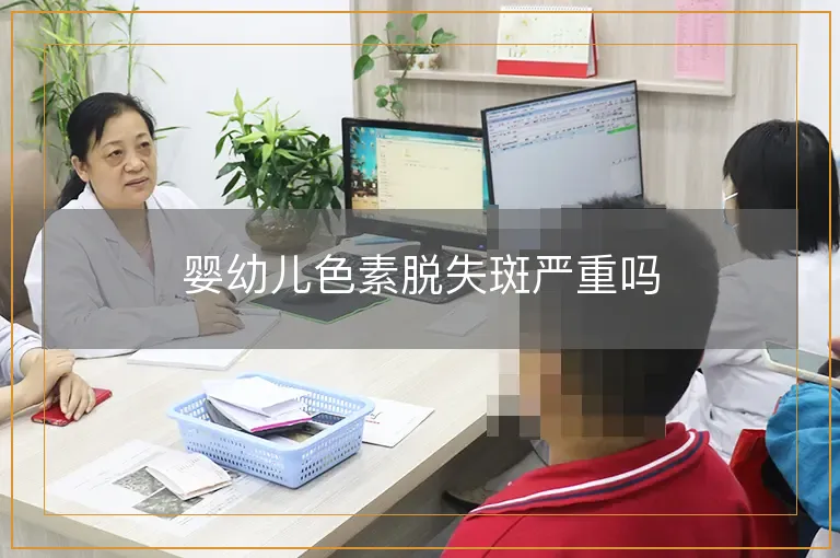 婴幼儿色素脱失斑严重吗