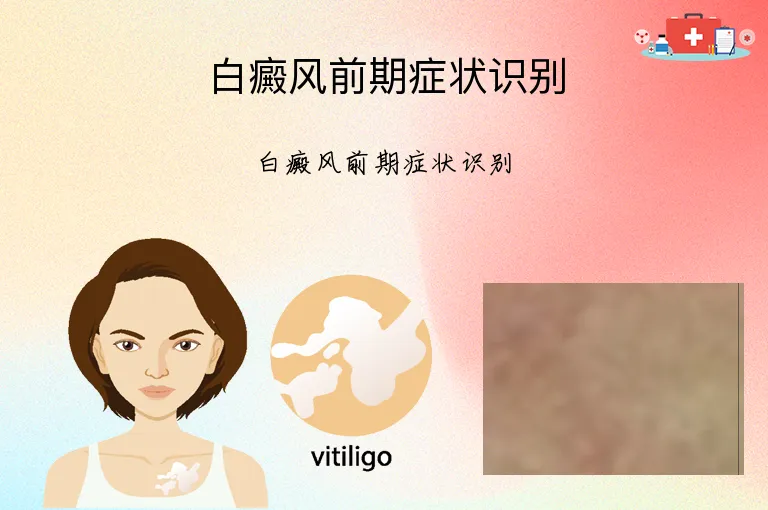 白癜风前期症状识别