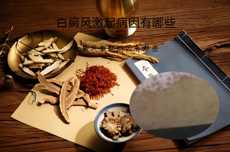 白癜风激起病因有哪些
