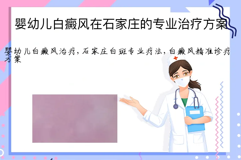 婴幼儿白癜风在石家庄的专业治疗方案