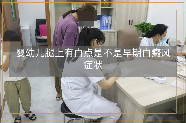 婴幼儿腿上有白点是不是早期白癜风症状
