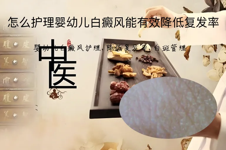 怎么护理婴幼儿白癜风能有效降低复发率