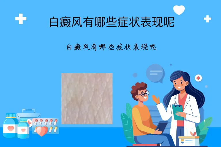 白癜风有哪些症状表现呢