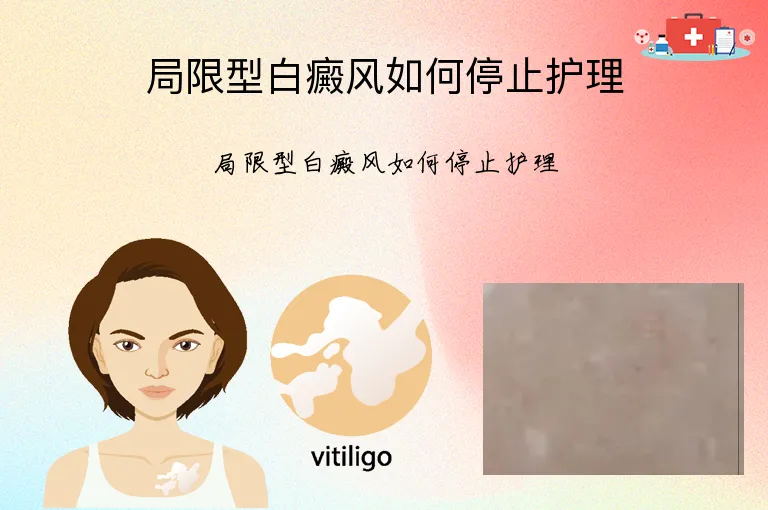 局限型白癜风如何停止护理