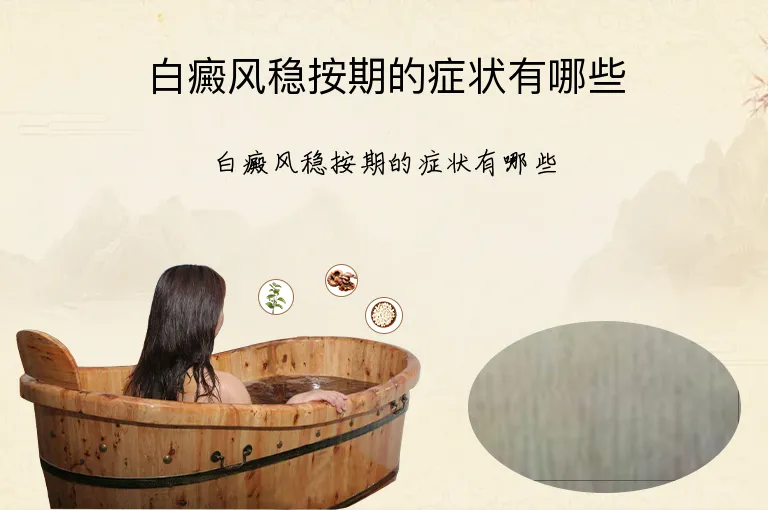 白癜风稳按期的症状有哪些