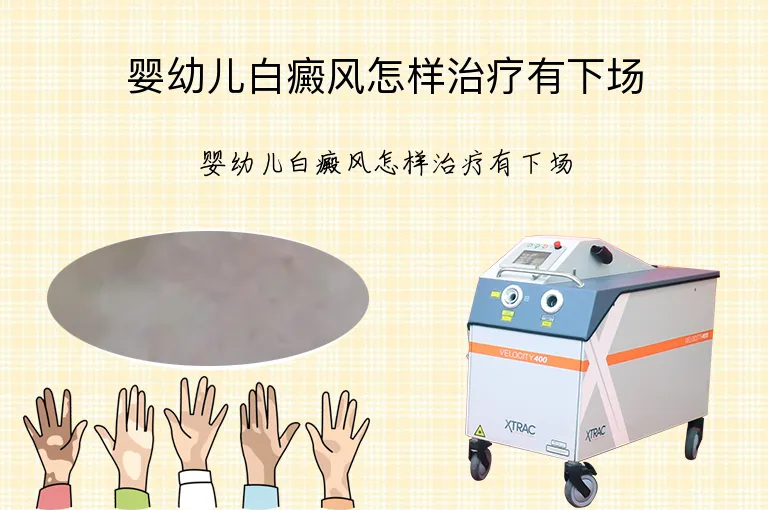 婴幼儿白癜风怎样治疗有下场
