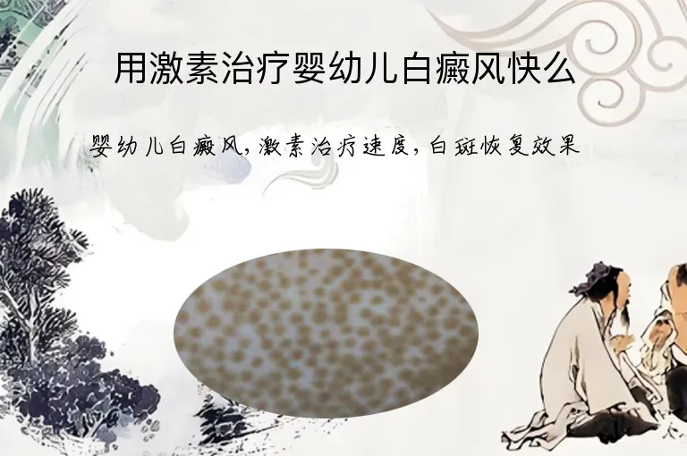 用激素治疗婴幼儿白癜风快么