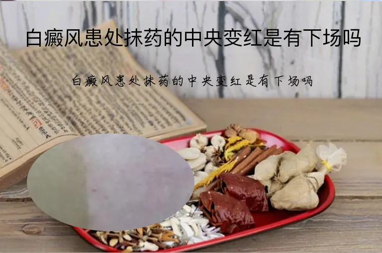 白癜风患处抹药的中央变红是有下场吗