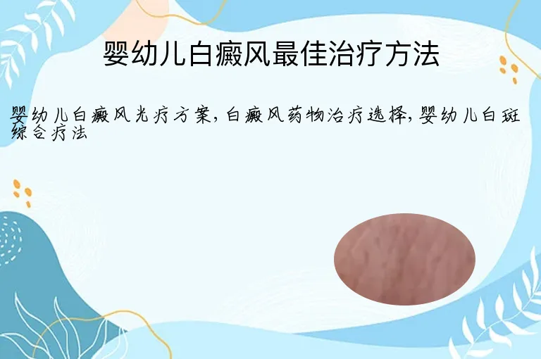婴幼儿白癜风最佳治疗方法