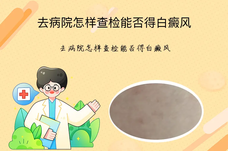 去病院怎样查检能否得白癜风