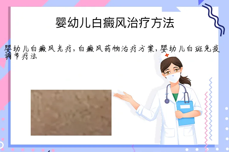 婴幼儿白癜风治疗方法