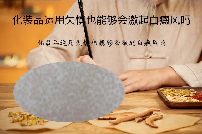 化装品运用失慎也能够会激起白癜风吗