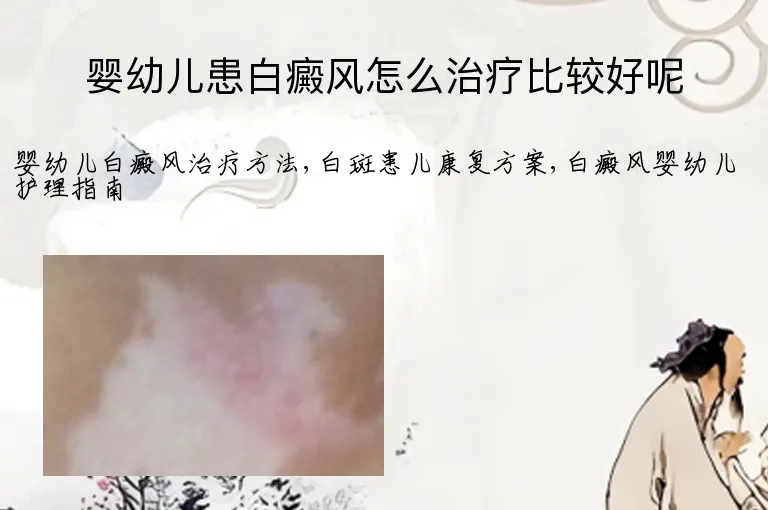 婴幼儿患白癜风怎么治疗比较好呢
