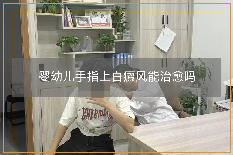婴幼儿手指上白癜风能治愈吗