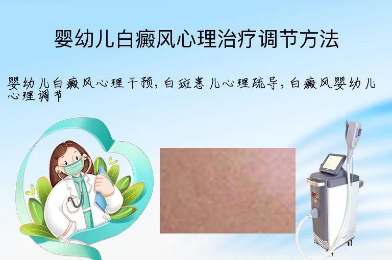 婴幼儿白癜风心理治疗调节方法