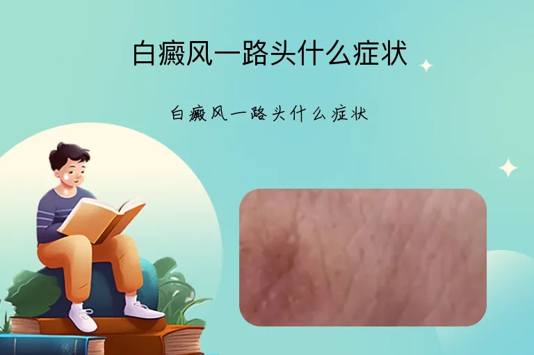 白癜风一路头什么症状