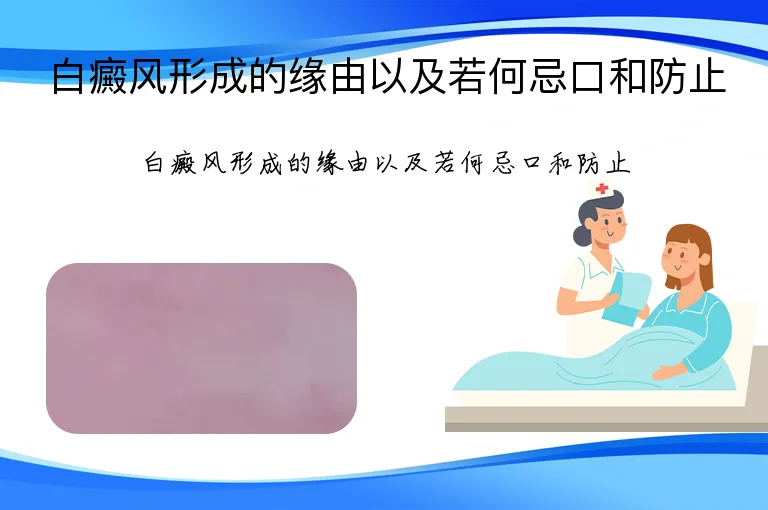 白癜风形成的缘由以及若何忌口和防止