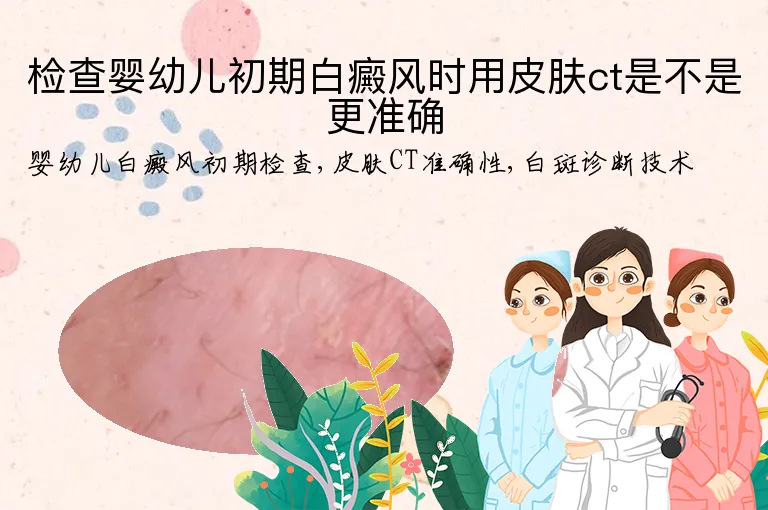 检查婴幼儿初期白癜风时用皮肤ct是不是更准确