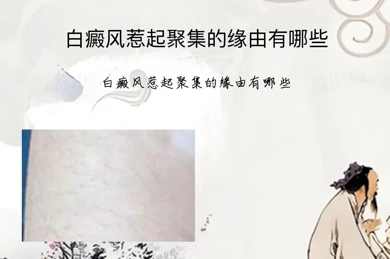 白癜风惹起聚集的缘由有哪些