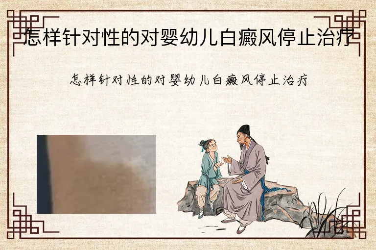 怎样针对性的对婴幼儿白癜风停止治疗