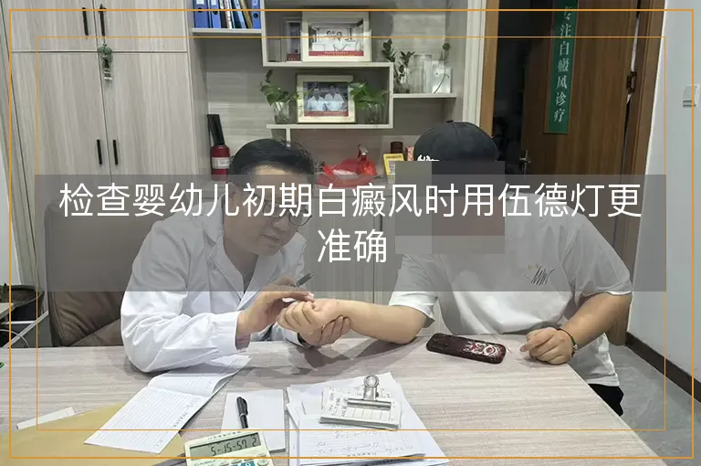 检查婴幼儿初期白癜风时用伍德灯更准确