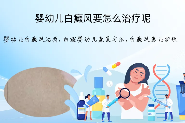 婴幼儿白癜风要怎么治疗呢