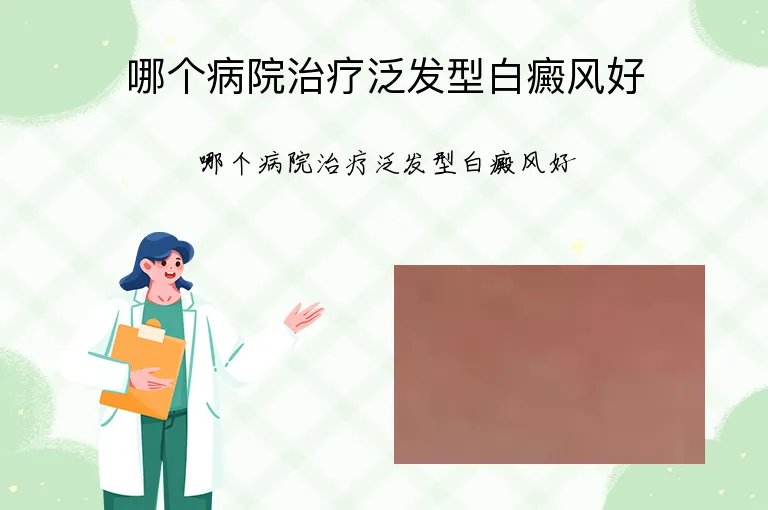 哪个病院治疗泛发型白癜风好